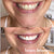 Beaut Beauty cozy smile kit Wireless Teeth Whitening Kit